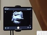 Snapshot Frame 12